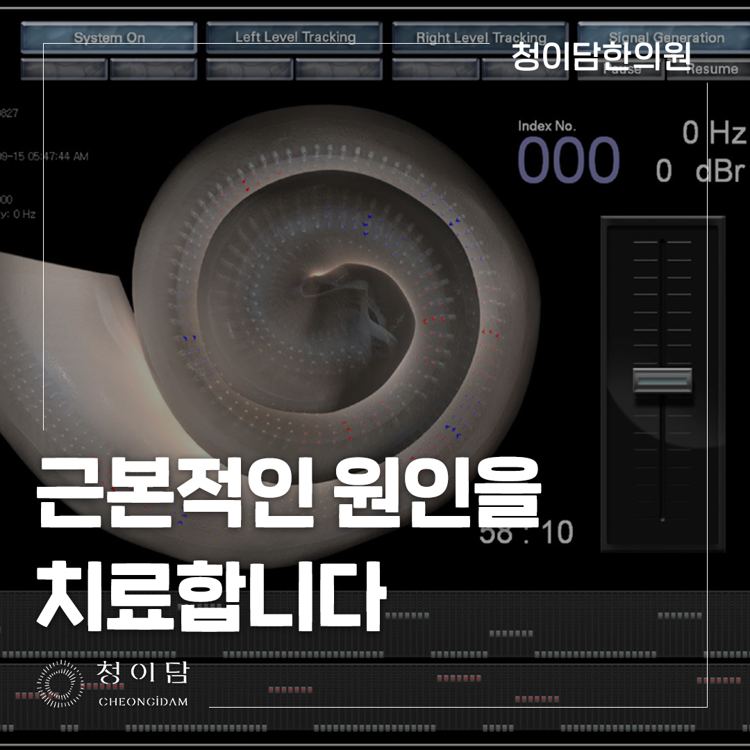 이명 약 찾기 전에 원인과 청력 변화를 먼저 살펴봅니다